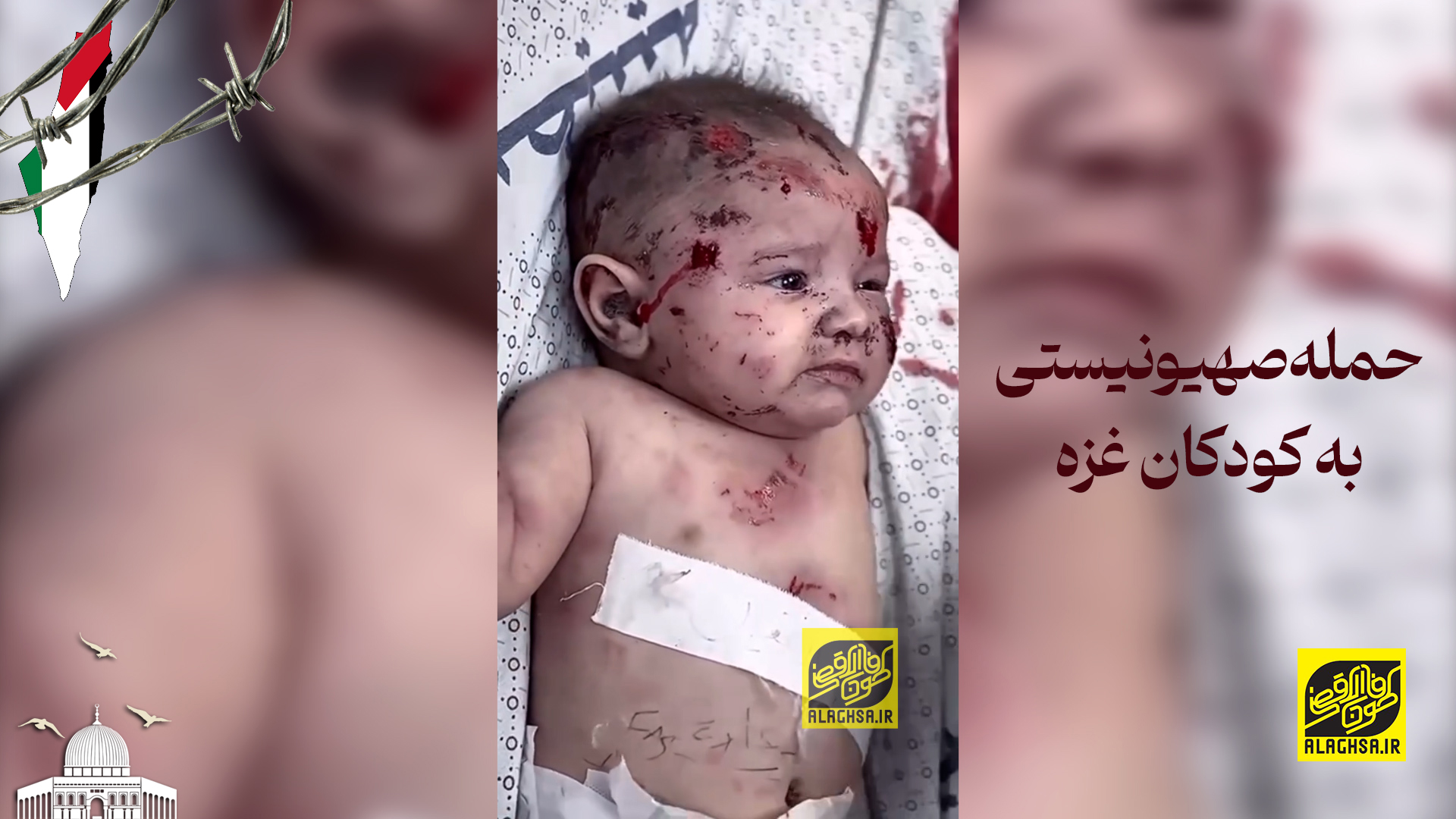 حمله صهیونیستی به کودکان غزه