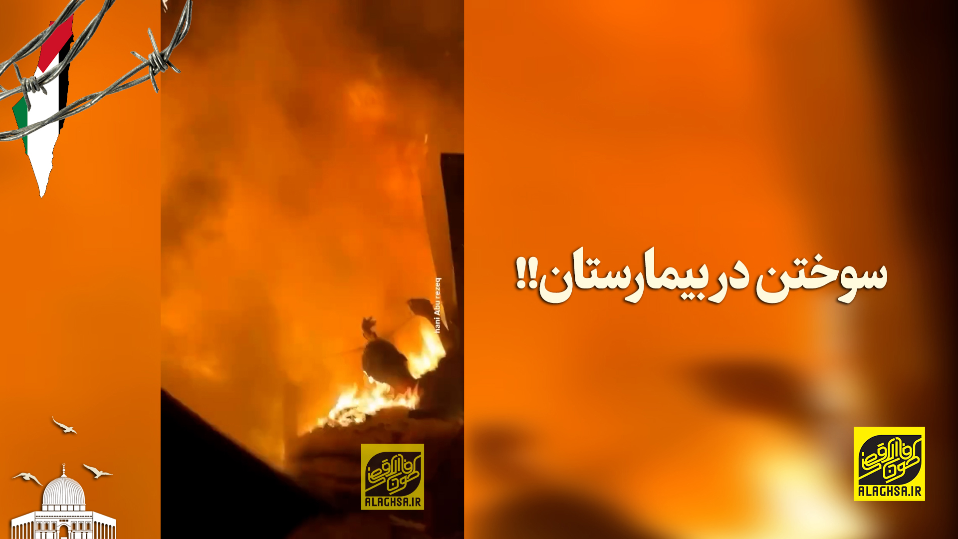 سوختن در بیمارستان!!